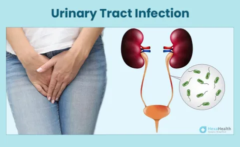 Managing Urinary Tract Infections: Prevention and Treatment Strategies in Jaipur