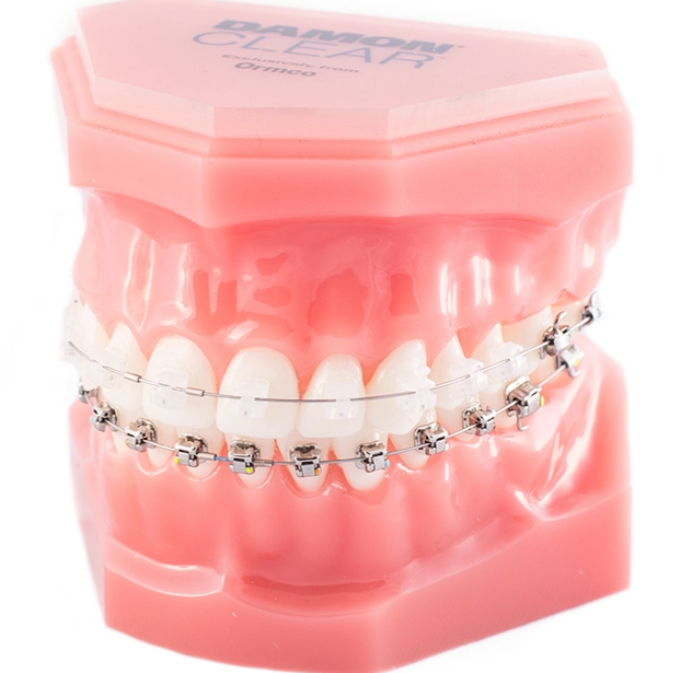 Transform Your Smile with a Trusted Orthodontist and Braces Expert