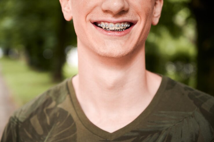 How Braces Can Improve Your Oral Health
